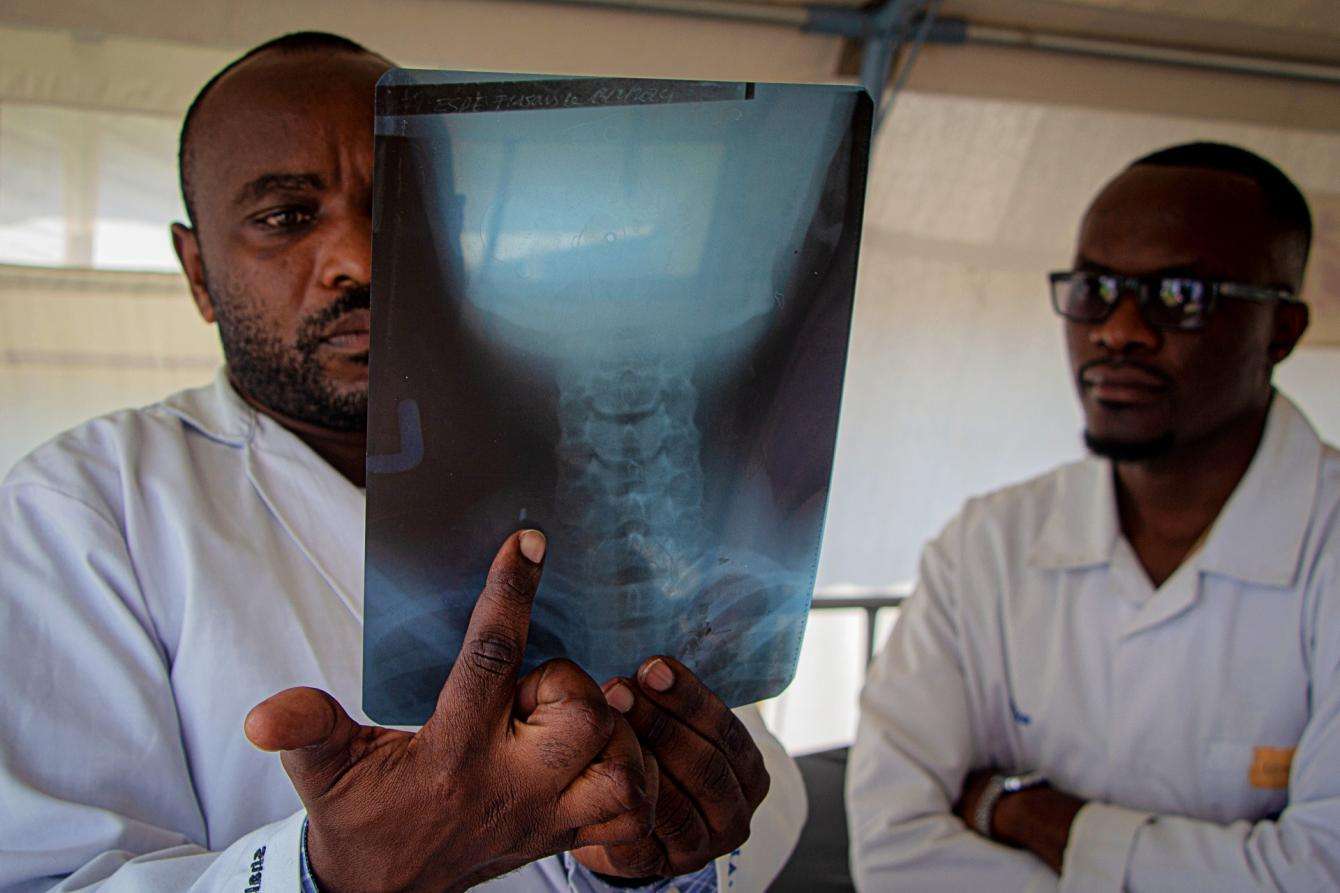 X-rays taken at Keshero hospital show the bullets and shrapnel still present in the bodies of some patients.