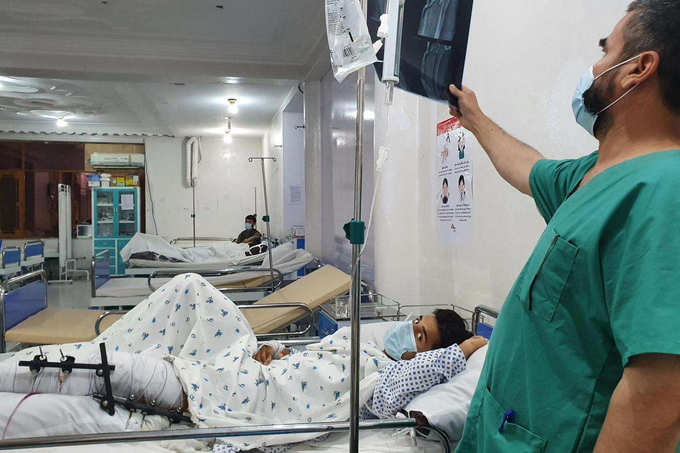 Inside the emergency room at MSF's Kunduz Emergency Trauma Unit a medic examines the X-ray of a patient who has suffered a complicated fracture of their upper and lower leg due to a bomb blast. Afghanistan 2021 © Stig Walravens/MSF